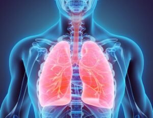 Actemra & Acute Respiratory Distress Syndrome